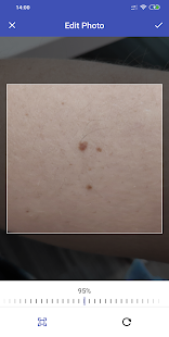 TrackYourSpot - Free Skin Cancer Tracker(圖3)-速報App