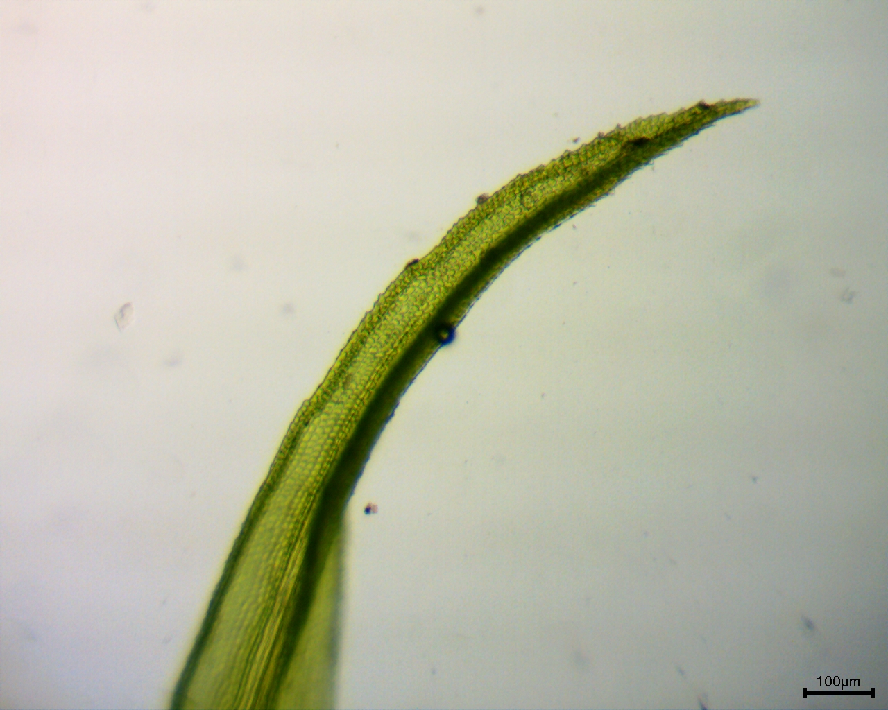 Scistidium apocarpum 100x leaf tip 2.jpg