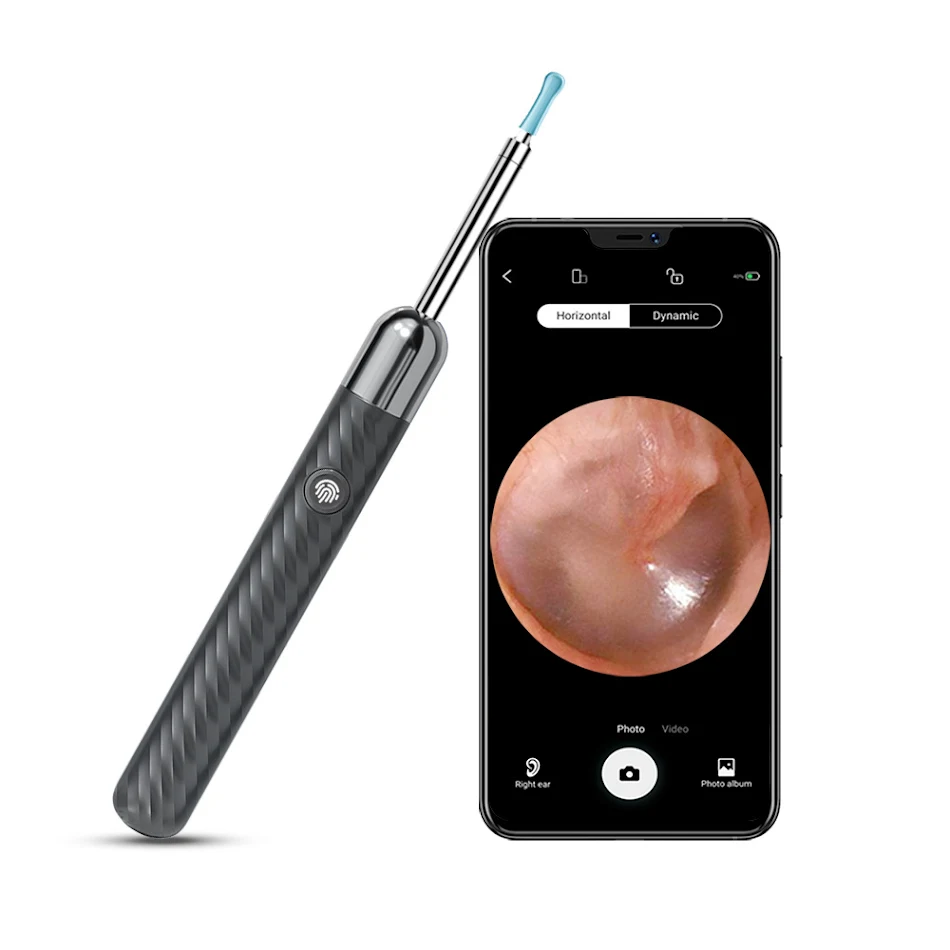 HD-Kamera Ohrenreiniger Visuelle Inspektion für saubere Ohren. Sichere Entfernung von Ohrenschmalz und verbesserte Ohrhygiene.