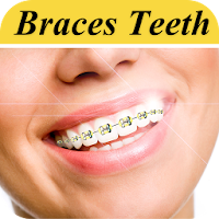 Braces Photo Editor