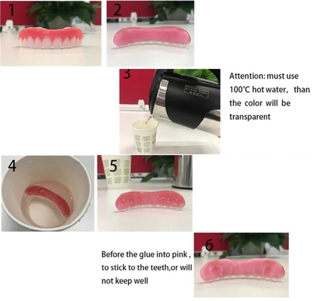 Title 3, Dents Artificielles en Silicone pour Dents Supé...
