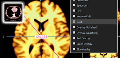 Dicom Medical Image Viewer Screenshot