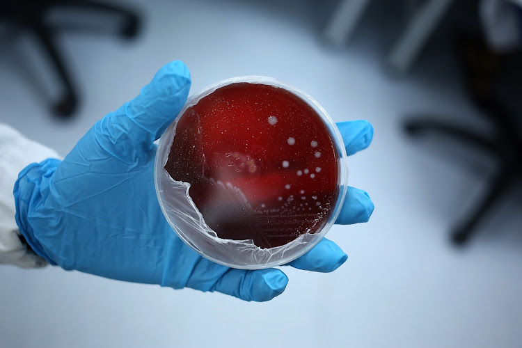 A listeria monocytogenes culture is seen in a lab at The National Institute for Communicable Diseases in Johannesburg.