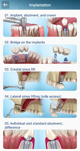 Screenshot Dental 3D Illustrations