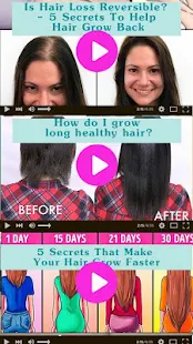 Hair Growth (tips, oil, food ,products, treatment)(圖3)-速報App