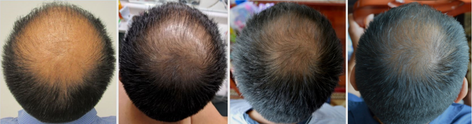 Re-Grow Your Natural Hair with Dr. Ray Nettles Stopandregrow.com