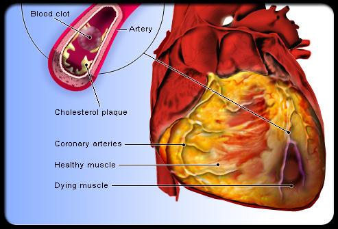 免費下載醫療APP|Guide Coronary Artery Disease app開箱文|APP開箱王