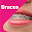 Braces Photo Editor App Download on Windows