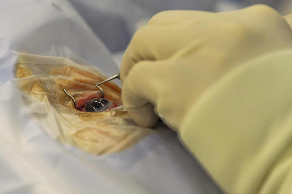 Eyelid surgery close up.