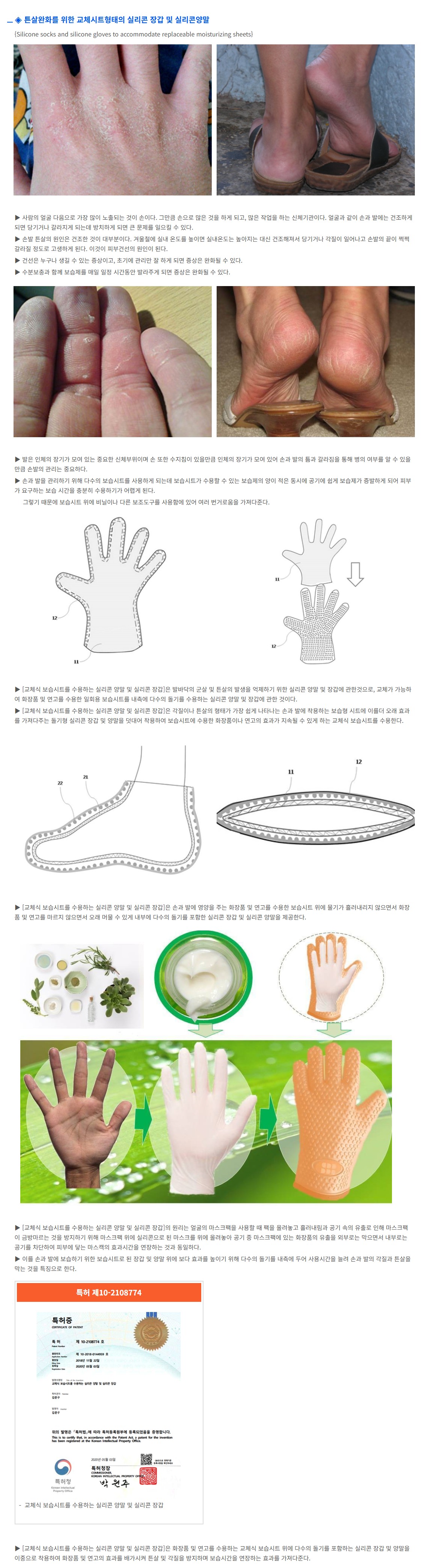 튼살_완화_장갑.JPG