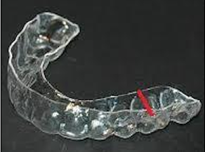 orthodontist-in-richmond-83