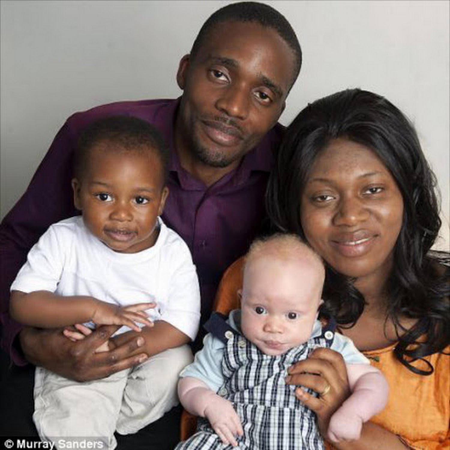 Parents give birth to black baby