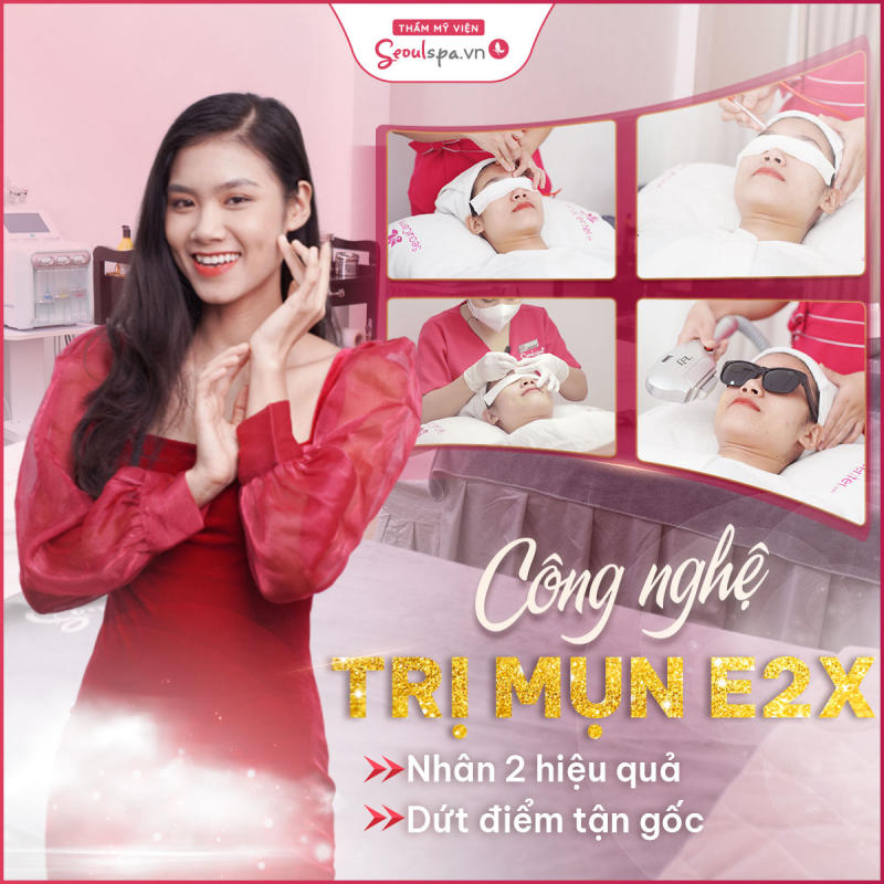 Trị mụn bằng công nghệ E2X