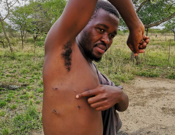 Sabelo Masondo shows the wounds inflicted on him by a lion.