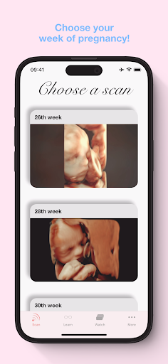 Screenshot ScanBaby learn baby ultrasound