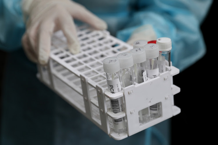 Covid-19 polymerase chain reaction (PCR) swab test tubes. The Competition Commission has found that private laboratories have been overcharging for these tests, but will not be fining those companies in return for an immediate cost reduction on the tests.