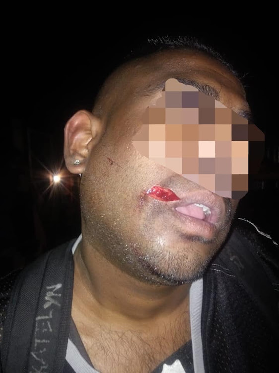 A Verulam man was stabbed in the face, allegedly by his brother in an apparent argument over Lotto winnings. Reaction Unit members arrested the man who was handed over to police