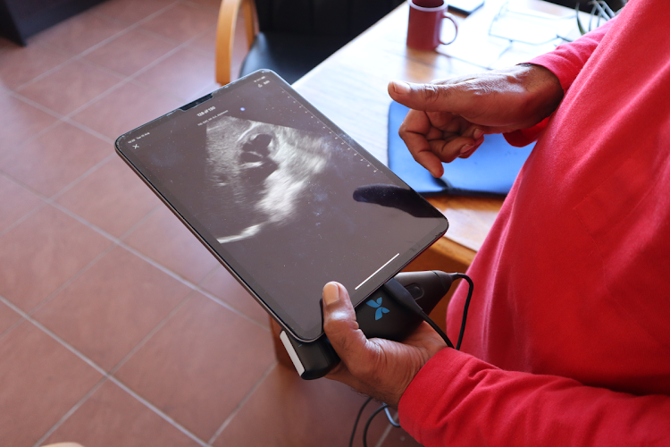 A portable ultrasound device gives Variava ‘eyes’ that have transformed how he practises medicine. Picture: Sean Christie