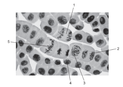 Gene mutations