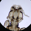 Avian Louse