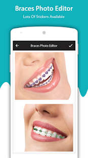 Braces Photo(圖6)-速報App