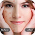 Face Blemish Remover - Smooth Skin & Beautify Face1.2