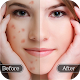 Face Blemish Remover - Smooth Skin & Beautify Face Download on Windows