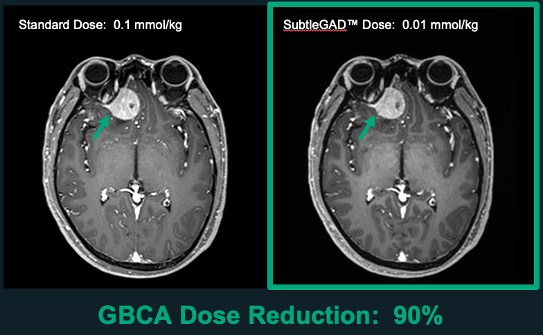 SubtlePET 2.0 Gets CE Mark • APPLIED RADIOLOGY