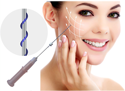 căng chỉ là phương pháp dùng chỉ sinh học cao cấp để gây ra phản ứng viêm tại chỗ, kích thích cơ chế tự làm lành của cơ thể