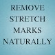 Download Get Rid Of Stretch Marks Naturally For PC Windows and Mac 1.0