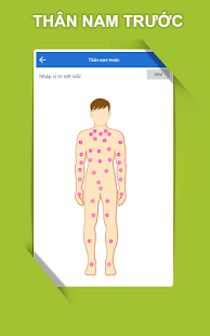 Xem Bói Nốt Ruồi-Bói Nốt Ruồi Trên Mặt-Tay- Cơ Thể(圖4)-速報App