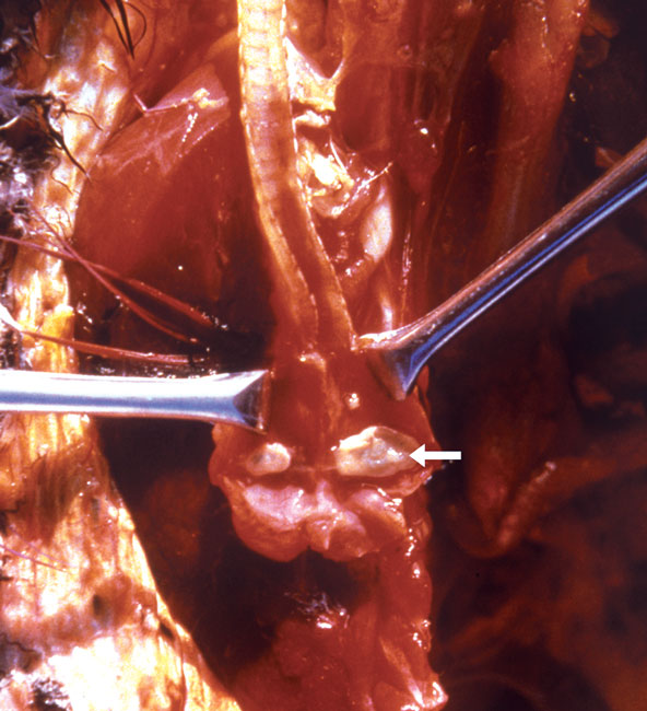 Granuloma (arrow) of the syrinx in a blue-headed pionus parrot