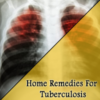 Home Remedies For Tuberculosis TB