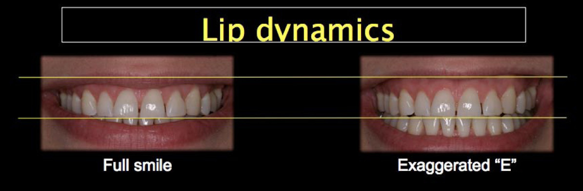 The dynamics of your lips