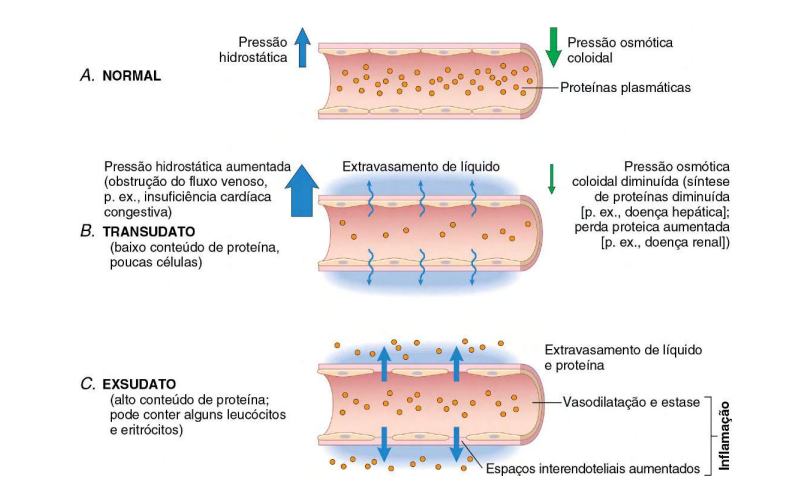 Fisiologia Do Processo Inflamatório, PDF, Inflamação