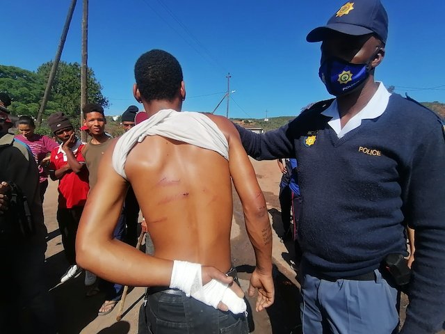 Enrico Classen of Enon location after being beaten by anti-crime forum members.