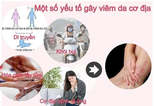 TOP 5 BÁC SĨ HỖ TRỢ ĐIỀU TRỊ VIÊM DA CƠ ĐỊA GIỎI TẠI HÀ NỘI