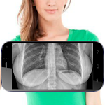 X-Ray Body Scanner Camera Apk