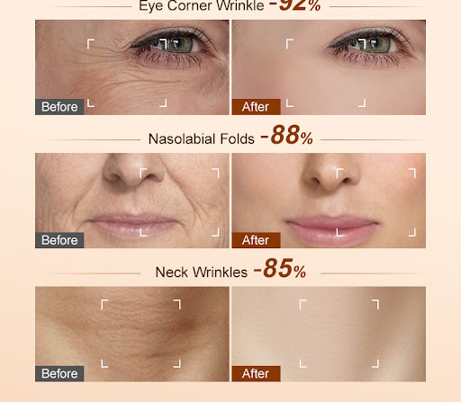 Title 8, Moisturizing Face Cream for Brightening Dull Sk...