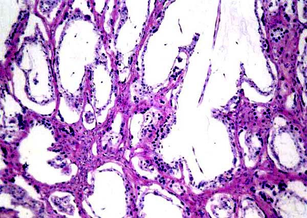 Villi and purple maternal tissue interdigitating