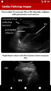 POC Ultrasound Guide(圖3)-速報App