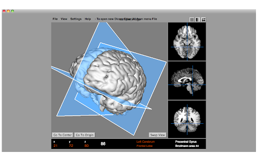 Dicom Medical Image Viewer