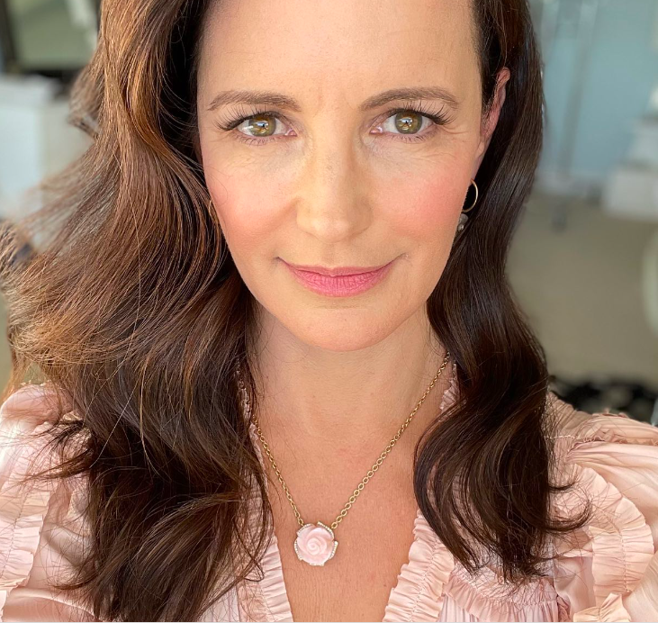 Kristin Davis lip fillers