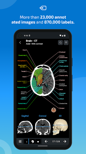 Screenshot e-Anatomy