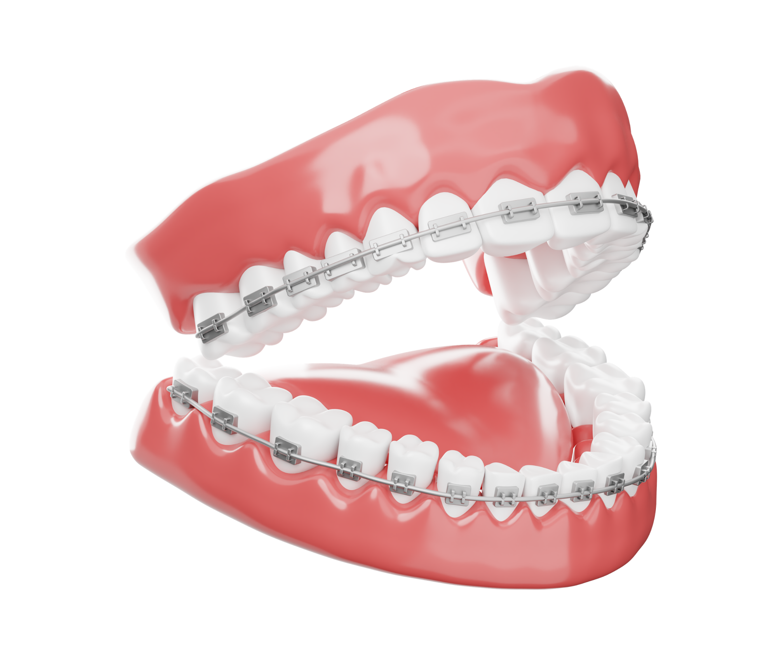 تقويم الأسنان