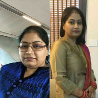 110075 Weight loss in Dwarka