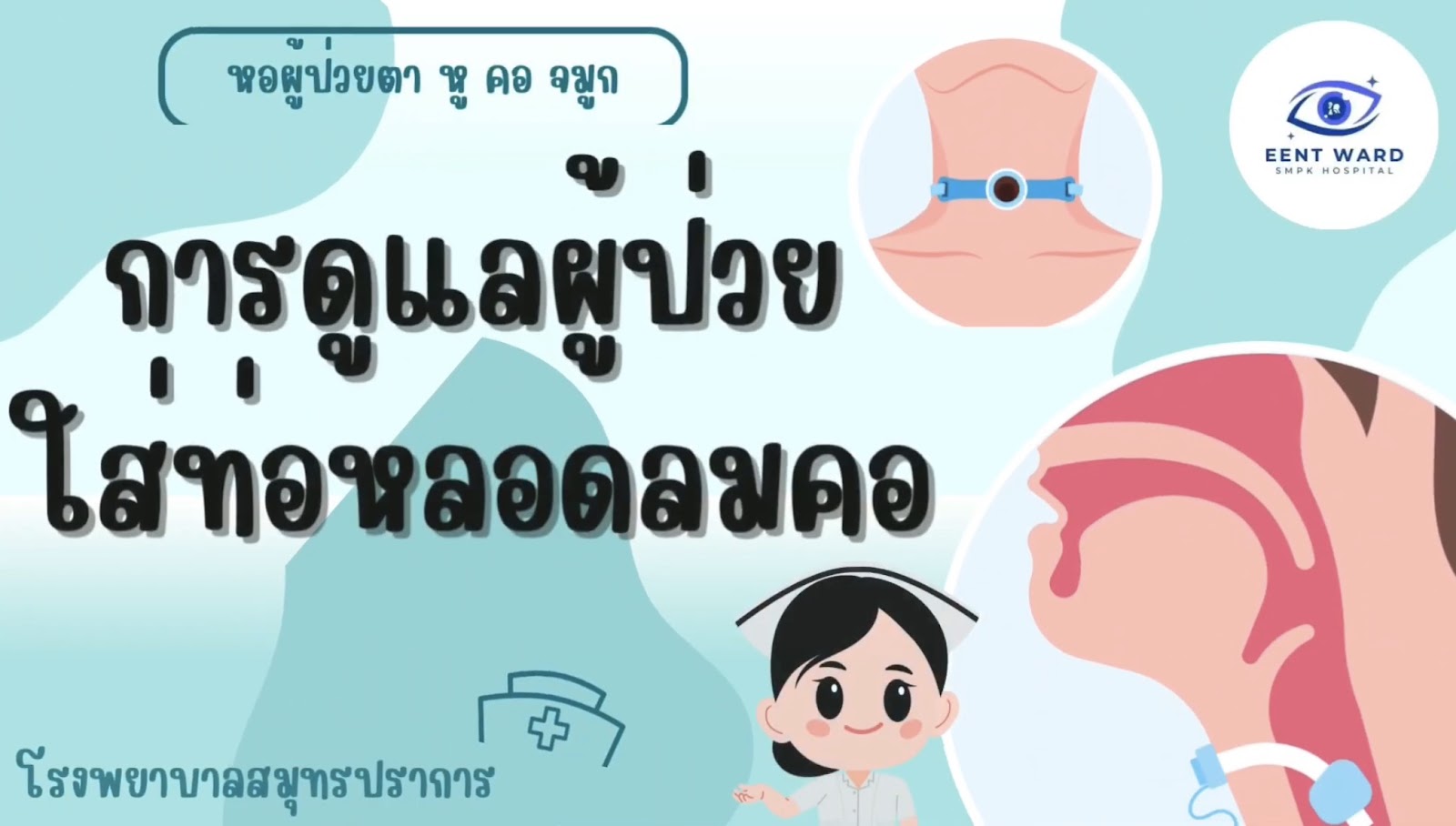 การดูแลผู้ป่วยใส่ท่อหลอดลมคอ
