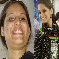 110092 Herbalife skin booster results in Shreshtha Vihar