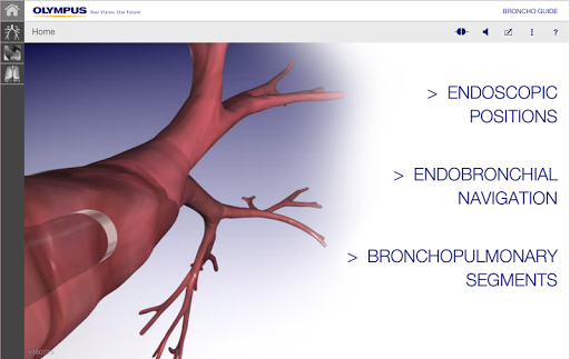 BronchoGuide