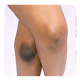 Download Bleaching the knees For PC Windows and Mac 1.0